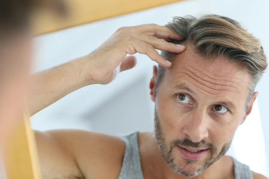 Hair-Restoration-Doctor A man looks in the mirror and inspects the part in his hair, worried about hair loss. Schedule Nutrafol treatments from Raving Health in Virginia Beach.
