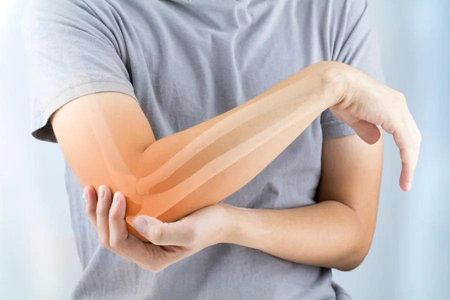 Osteoporosis-Doctor A close-up of a woman holding her elbow with an illustration of the bones and joint experiencing pain from osteoporosis. Get osteoporosis treatment from Raving Health in Virginia Beach.