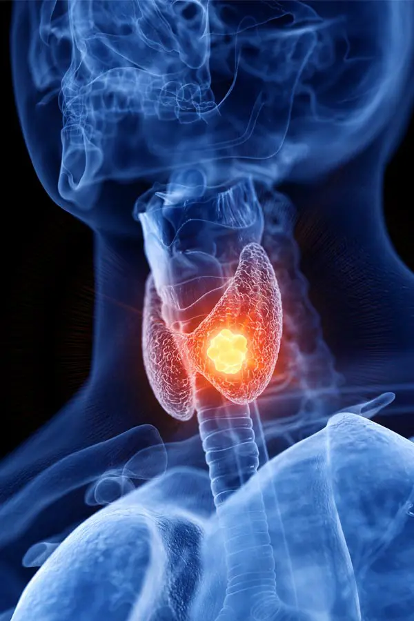 Thyroid-Imbalance-Treatment A 3D illustration of an x-ray of a human neck, highlighting the thyroid. Get help with thyroid imbalance from Raving Health in Virginia Beach.